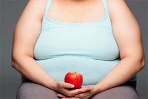 Um Krampfadern zu heilen, ist eine Gewichtsabnahme erforderlich.